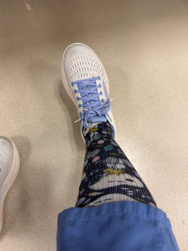 Reviewer's close-up of their patterned Beagle Ballet Compression Socks worn with a white sneaker.